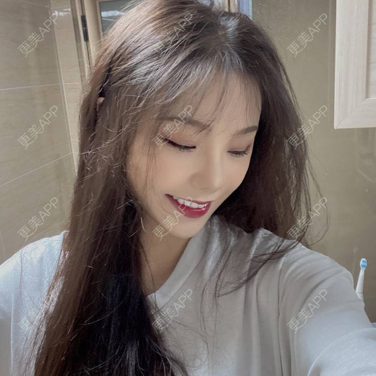 更美 - 天使爱美丽1的下颌角切除经验 | 广州 | 视频日记 | 下颌角切除