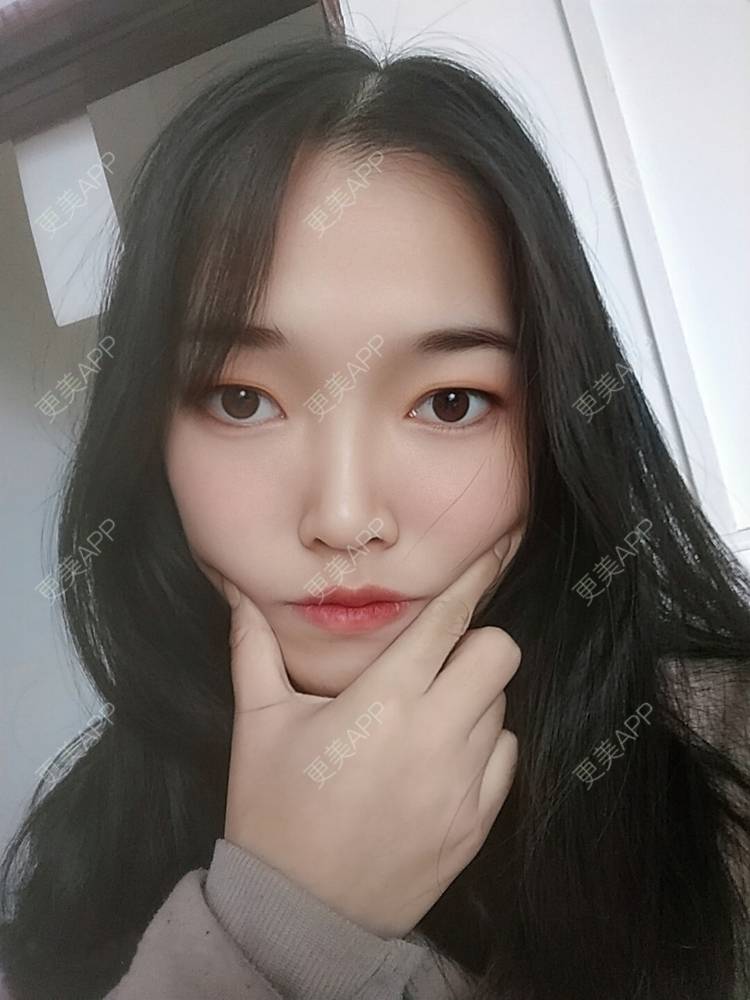 更美 - 更美用户d3VL5UQGsk的热拉提经验 | 上海 | 热拉提