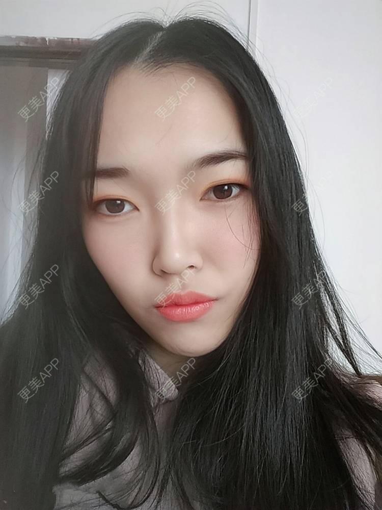 更美 - 更美用户d3VL5UQGsk的热拉提经验 | 上海 | 热拉提