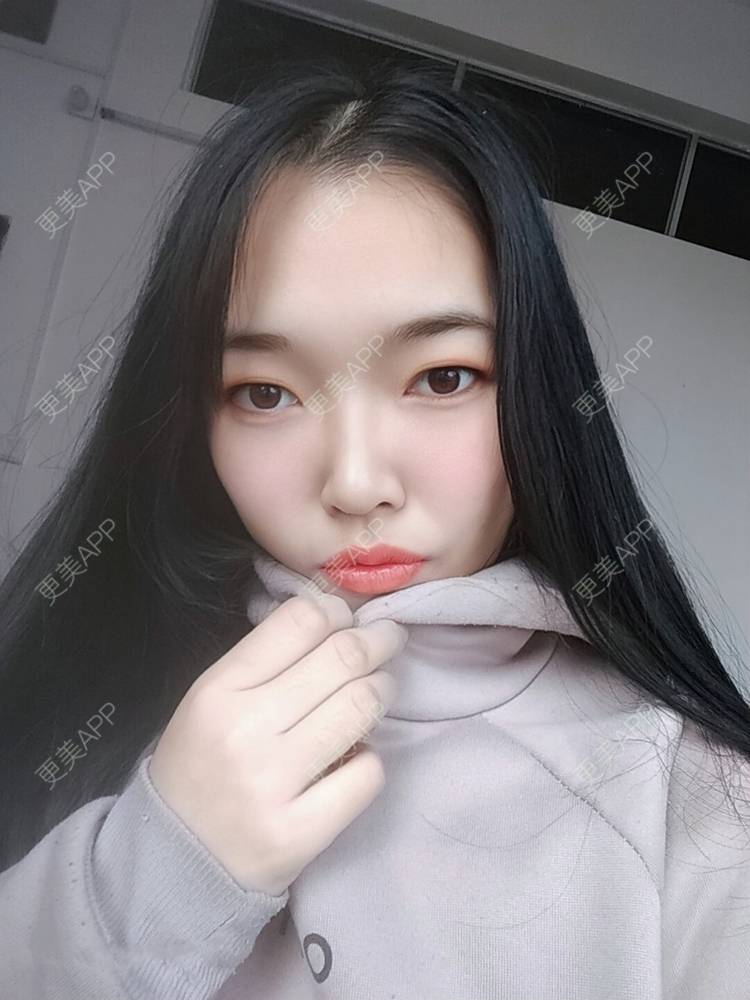 更美 - 更美用户d3VL5UQGsk的热拉提经验 | 上海 | 热拉提