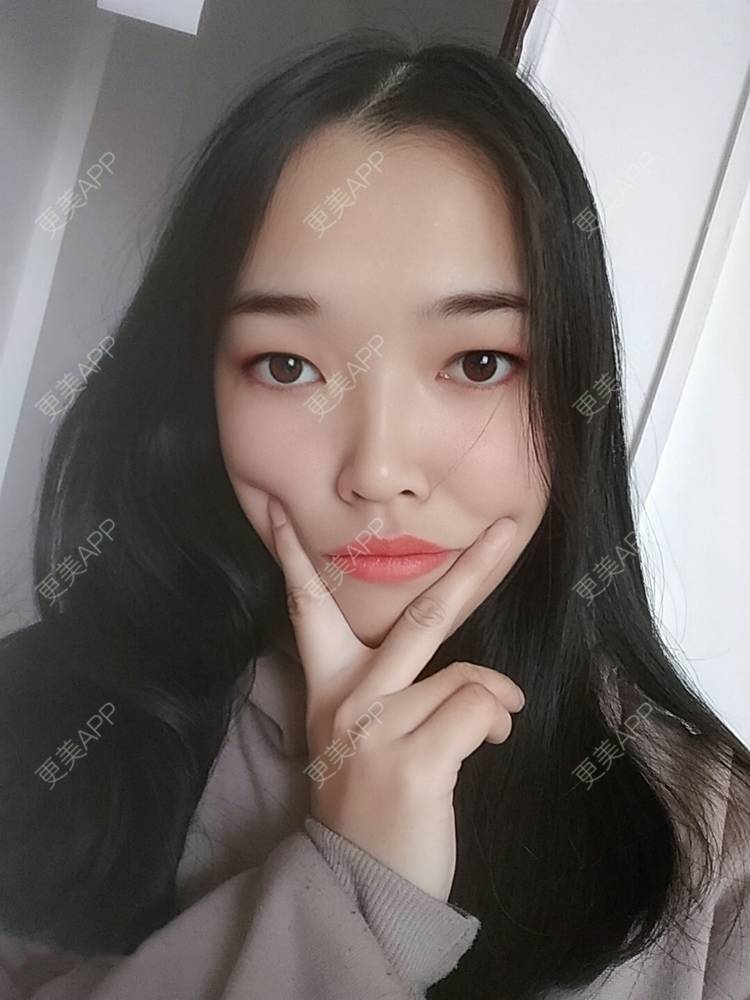 更美 - 更美用户d3VL5UQGsk的热拉提经验 | 上海 | 热拉提