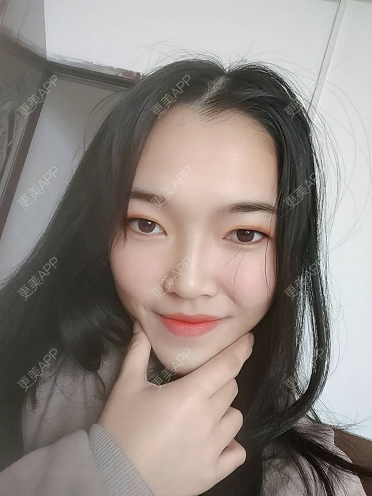 更美 - 更美用户d3VL5UQGsk的热拉提经验 | 上海 | 热拉提