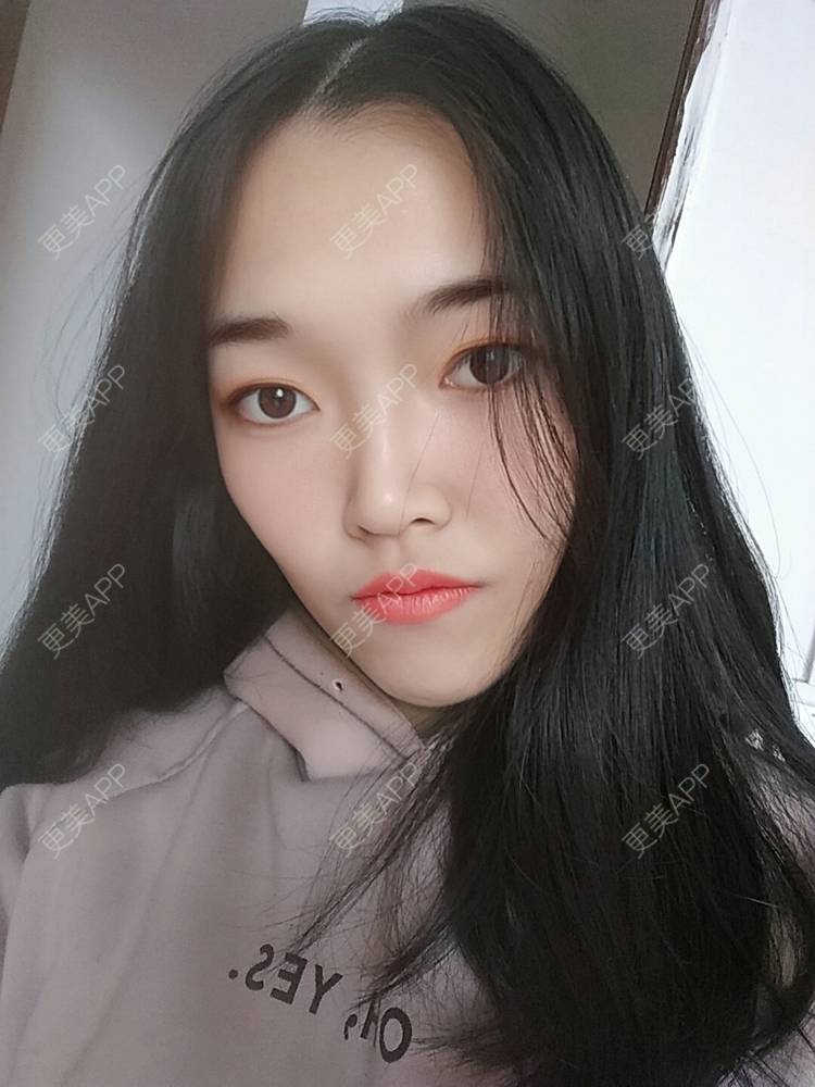 更美 - 更美用户d3VL5UQGsk的热拉提经验 | 上海 | 热拉提