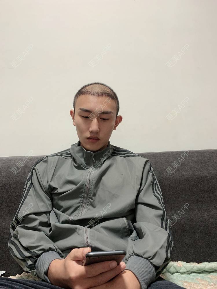 更美 - D调··的植发际线经验 | 植发际线 | 成都