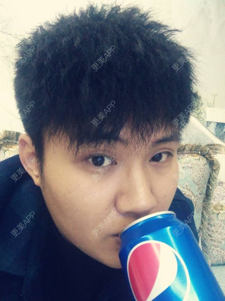 更美 - Wyl-.-的双眼皮经验 | 双眼皮 | 南昌