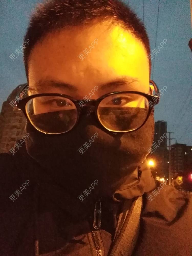 更美 - Wyl-.-的双眼皮经验 | 双眼皮 | 南昌