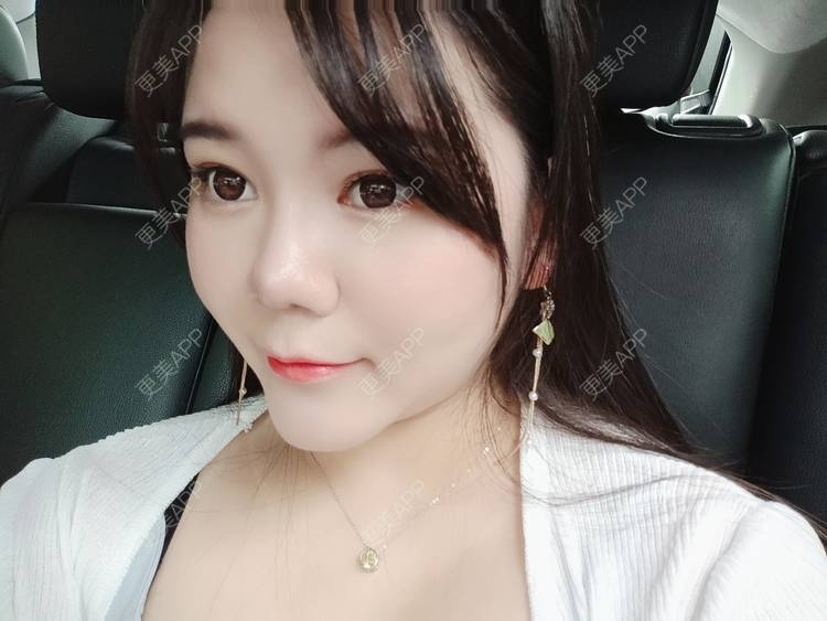 更美 - sonder.的下巴经验 | 下巴 | 硅胶垫下巴 | 长沙 | 视频日记