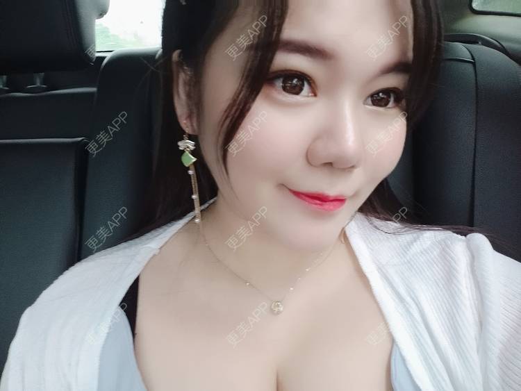 更美 - sonder.的下巴经验 | 下巴 | 硅胶垫下巴 | 长沙 | 视频日记