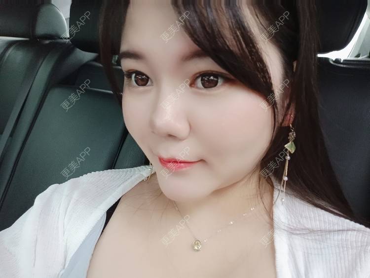 更美 - sonder.的下巴经验 | 下巴 | 硅胶垫下巴 | 长沙 | 视频日记