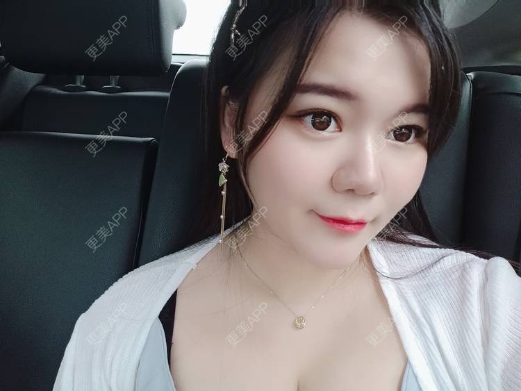 更美 - sonder.的下巴经验 | 下巴 | 硅胶垫下巴 | 长沙 | 视频日记