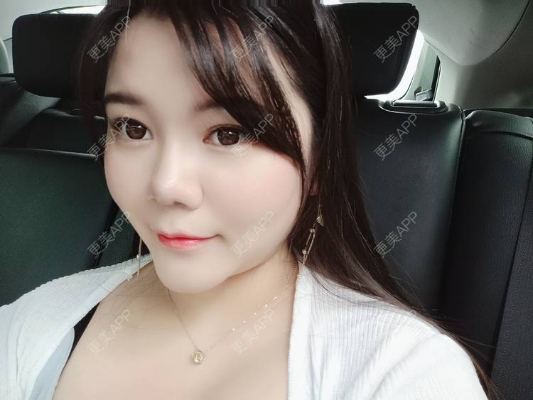 更美 - sonder.的下巴经验 | 下巴 | 硅胶垫下巴 | 长沙 | 视频日记