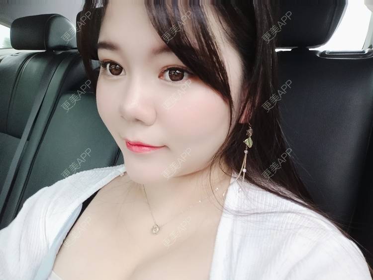 更美 - sonder.的下巴经验 | 下巴 | 硅胶垫下巴 | 长沙 | 视频日记