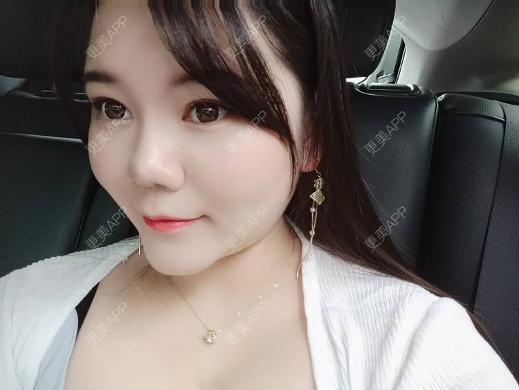 更美 - sonder.的下巴经验 | 下巴 | 硅胶垫下巴 | 长沙 | 视频日记