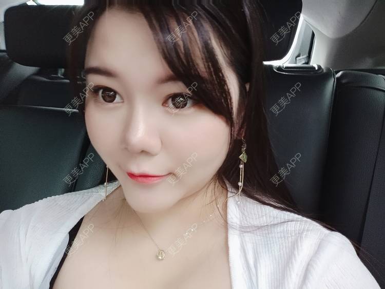 更美 - sonder.的下巴经验 | 下巴 | 硅胶垫下巴 | 长沙 | 视频日记