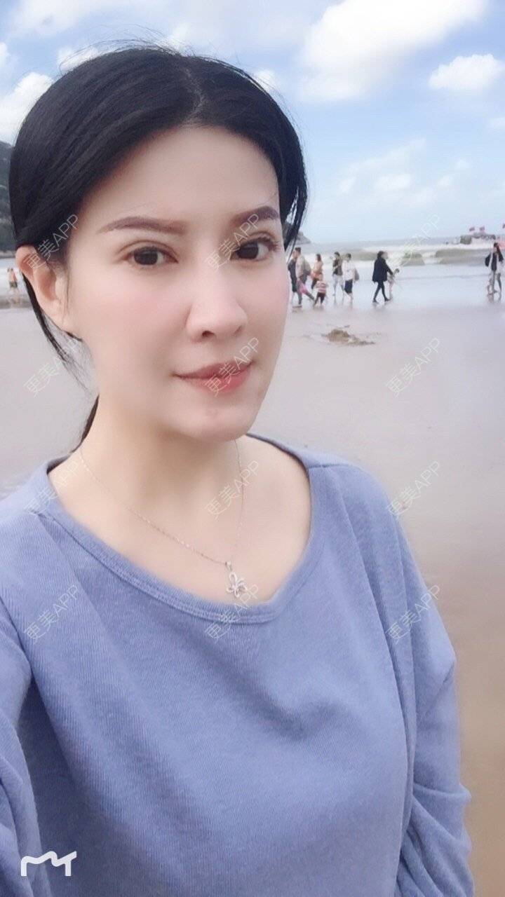 更美 - 甘思佳的热玛吉经验 | 北京 | 热玛吉