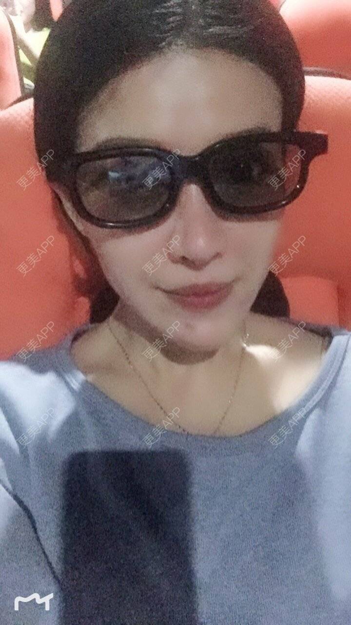 更美 - 甘思佳的热玛吉经验 | 北京 | 热玛吉