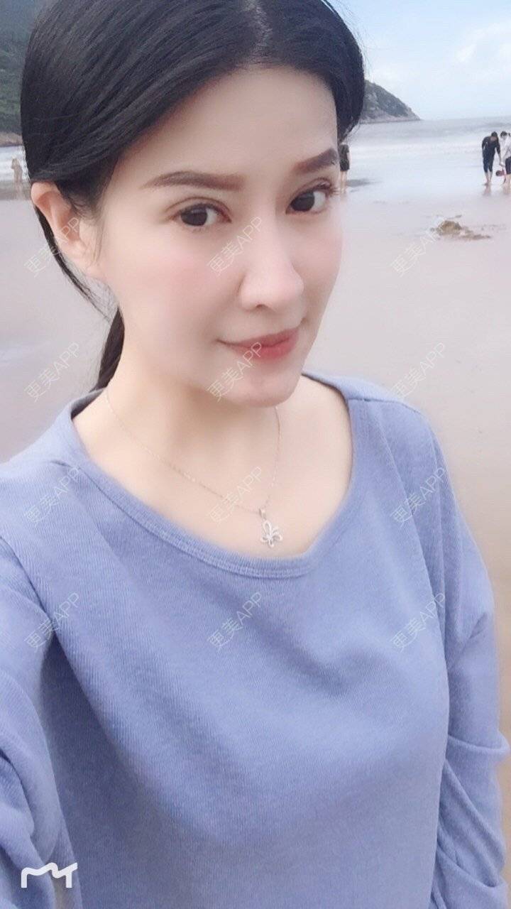 更美 - 甘思佳的热玛吉经验 | 北京 | 热玛吉