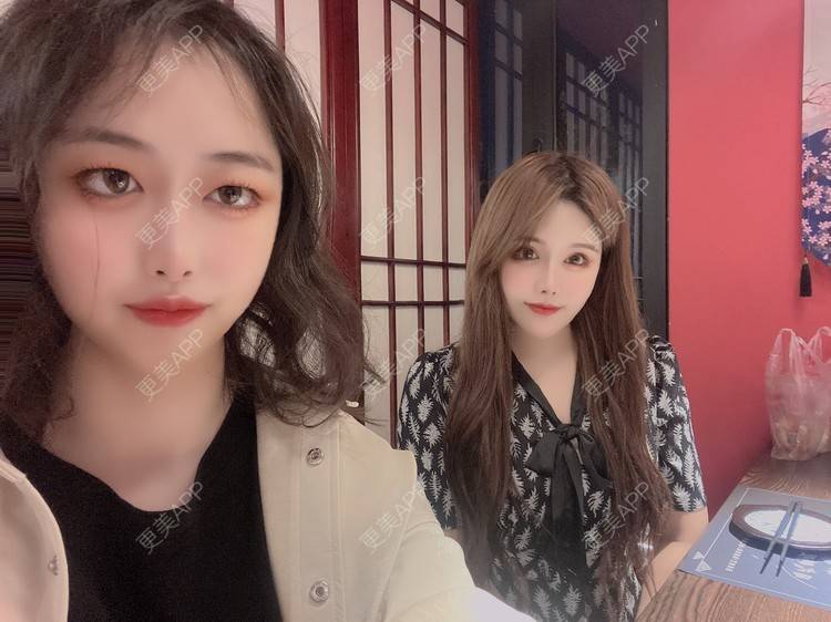 更美 - A.🌸大媛的肋软骨隆鼻经验 | 肋软骨隆鼻 | 郑州