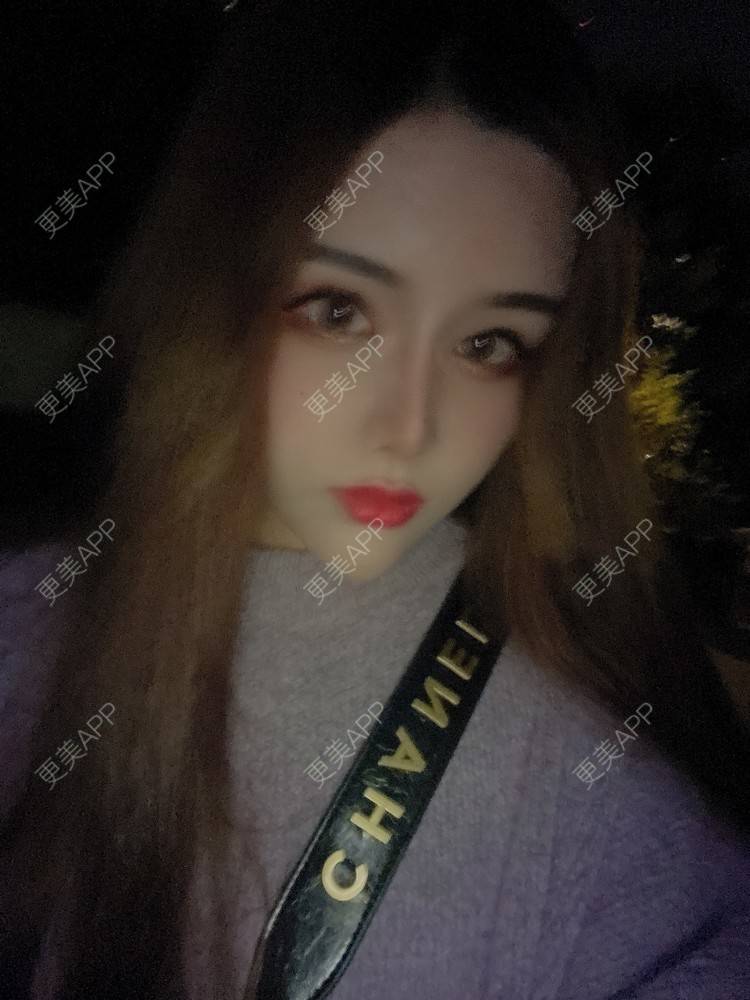 更美 - A.🌸大媛的肋软骨隆鼻经验 | 肋软骨隆鼻 | 郑州