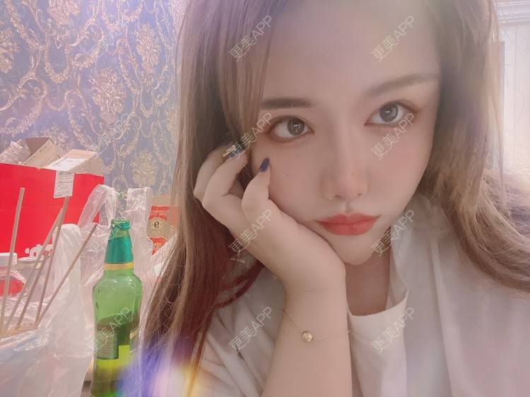 更美 - A.🌸大媛的肋软骨隆鼻经验 | 肋软骨隆鼻 | 郑州