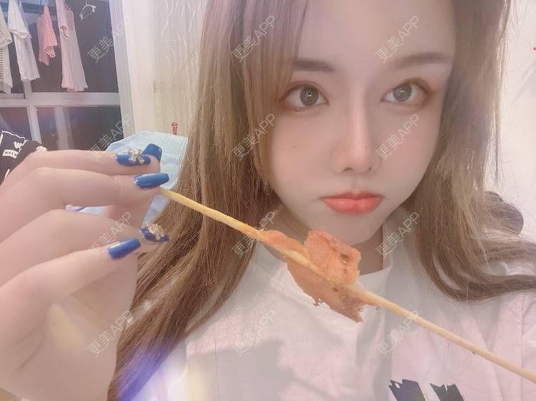 更美 - A.🌸大媛的肋软骨隆鼻经验 | 肋软骨隆鼻 | 郑州