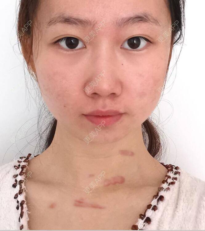 更美 - ﹌情詩fа濫杖的综合淡疤经验 | 综合淡疤 | 成都