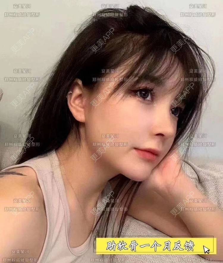 更美 - 郑州安美星河的鼻部膨体假体取出经验 | 鼻形态修复 | 鼻部膨体假体取出 | 鼻部硅胶假体取出 | 郑州