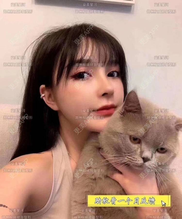 更美 - 郑州安美星河的鼻部膨体假体取出经验 | 鼻形态修复 | 鼻部膨体假体取出 | 鼻部硅胶假体取出 | 郑州