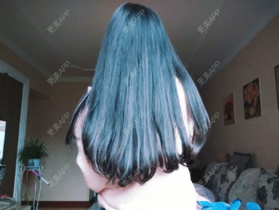 更美 - 更美用户1z8OrSUX5V的手术除腋臭经验 | 手术除腋臭