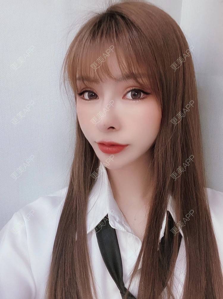 更美 - 橘子汽水789的肋软骨隆鼻经验 | 肋软骨隆鼻 | 广州