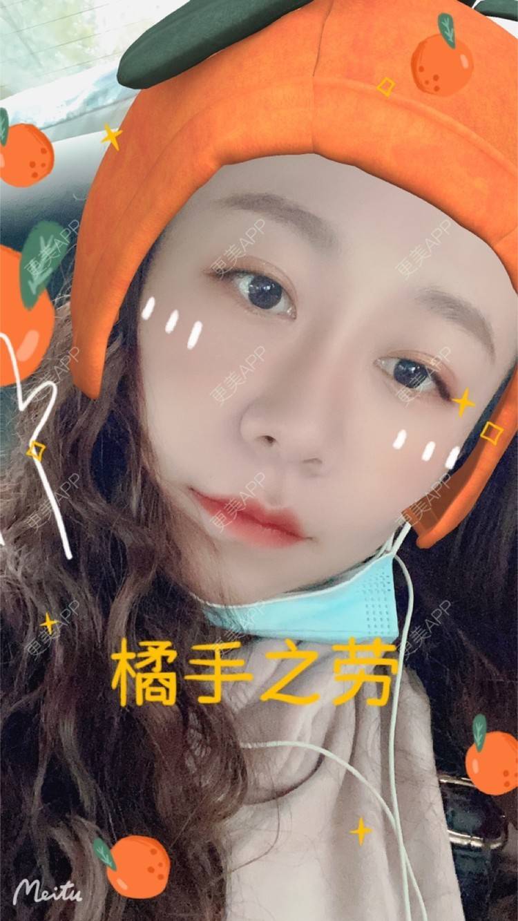 更美 - YXP💋的玻尿酸鼻部经验 | 玻尿酸鼻部 | 上海