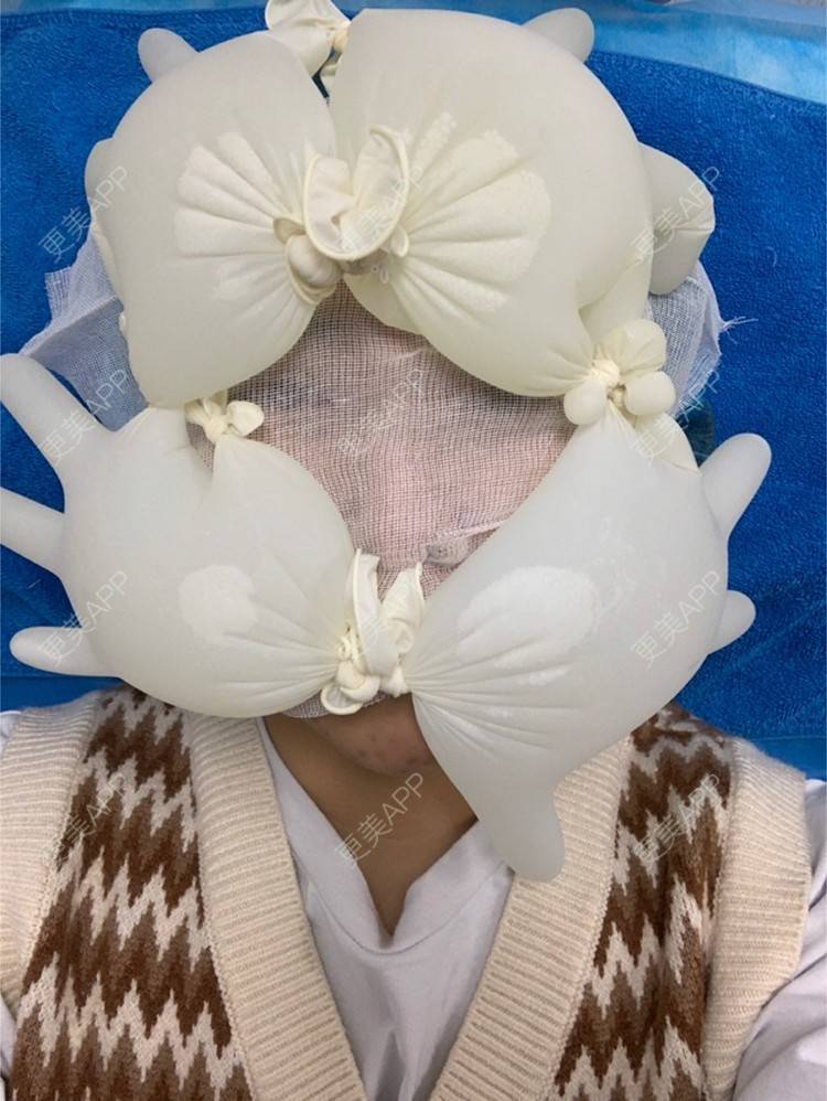 更美 - 更美用户VpFkTnuJED的光子嫩肤经验 | 光子嫩肤 | 上海