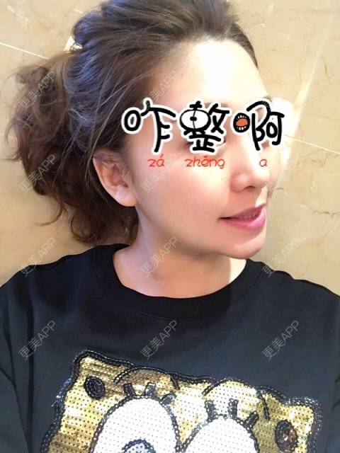 更美 - 更美用户7SHMGyRLay的拔龋齿经验 | 拔龋齿