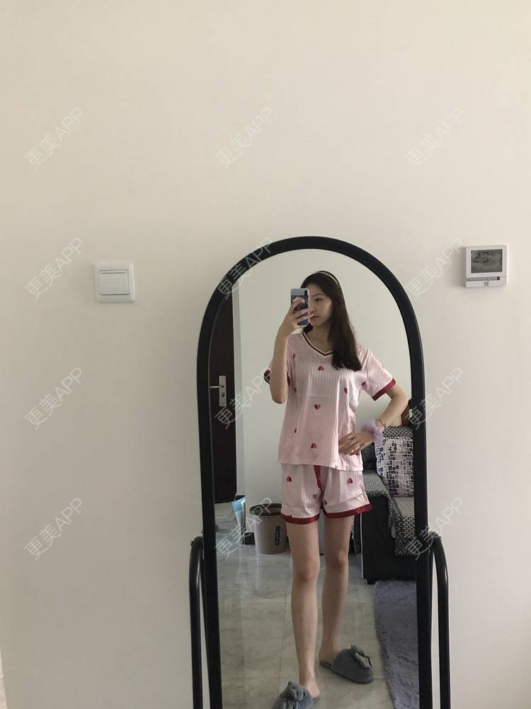 更美 - 巧巧儿🍒的吸脂瘦大腿经验 | 吸脂瘦大腿 | 南宁 | 吸脂