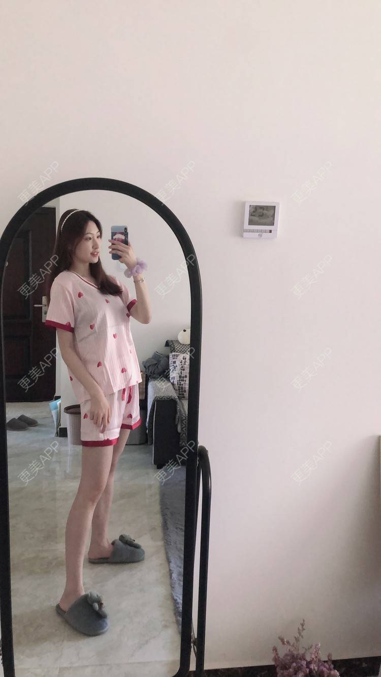 更美 - 巧巧儿🍒的吸脂瘦大腿经验 | 吸脂瘦大腿 | 南宁 | 吸脂