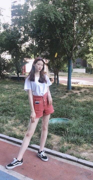 更美 - 巧巧儿🍒的吸脂瘦大腿经验 | 吸脂瘦大腿 | 南宁 | 吸脂