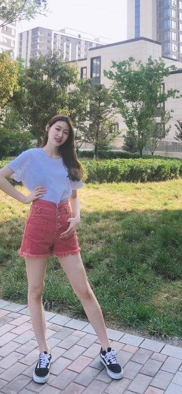 更美 - 巧巧儿🍒的吸脂瘦大腿经验 | 吸脂瘦大腿 | 南宁 | 吸脂