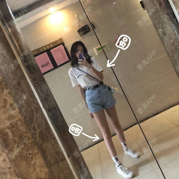 更美 - 十六叶的吸脂瘦大腿经验 | 吸脂瘦大腿 | 南宁 | 吸脂