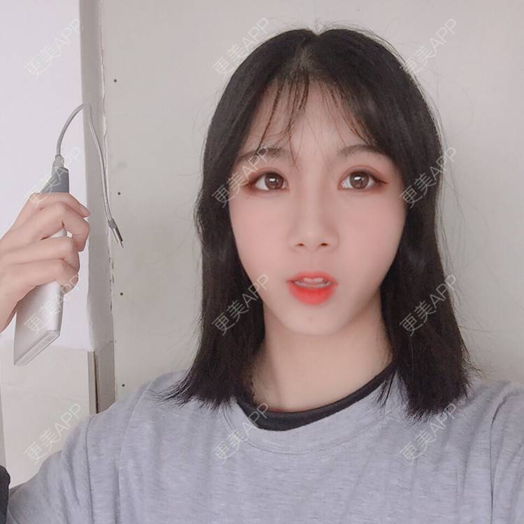 更美 - 更美用户5BT75lvkBb的热玛吉经验 | 广州 | 热玛吉