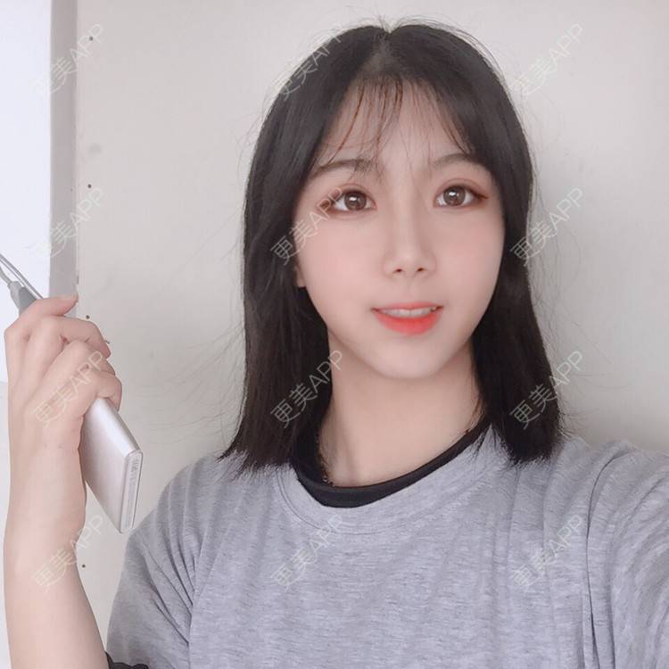 更美 - 更美用户5BT75lvkBb的热玛吉经验 | 广州 | 热玛吉