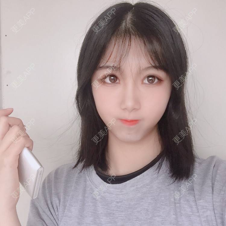 更美 - 更美用户5BT75lvkBb的热玛吉经验 | 广州 | 热玛吉