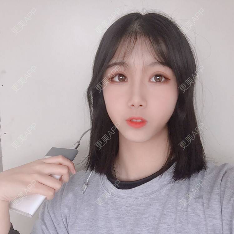 更美 - 更美用户5BT75lvkBb的热玛吉经验 | 广州 | 热玛吉