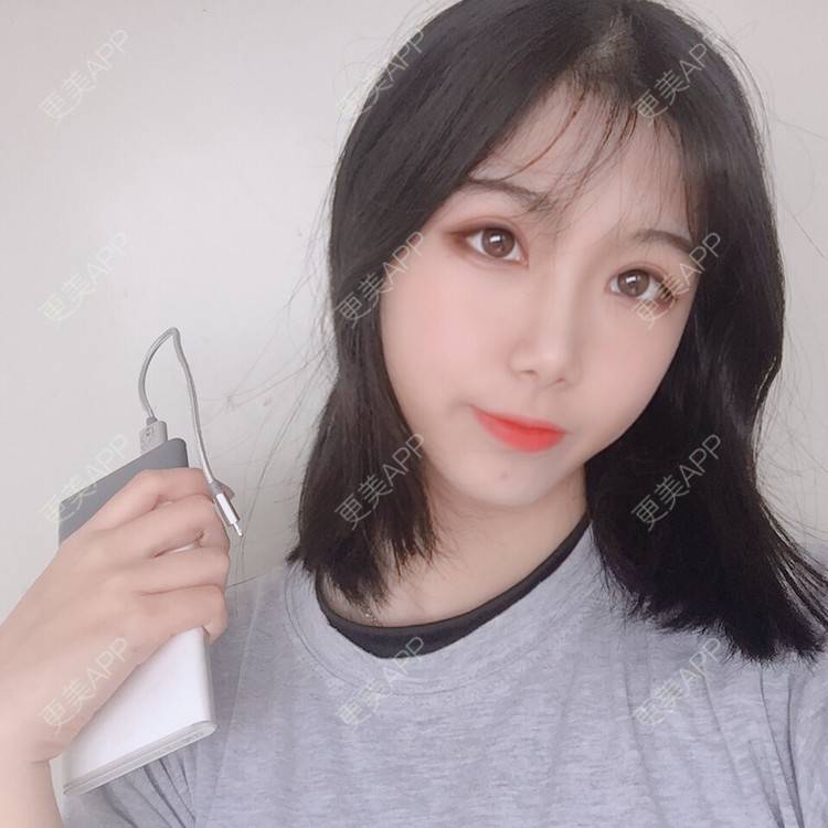 更美 - 更美用户5BT75lvkBb的热玛吉经验 | 广州 | 热玛吉