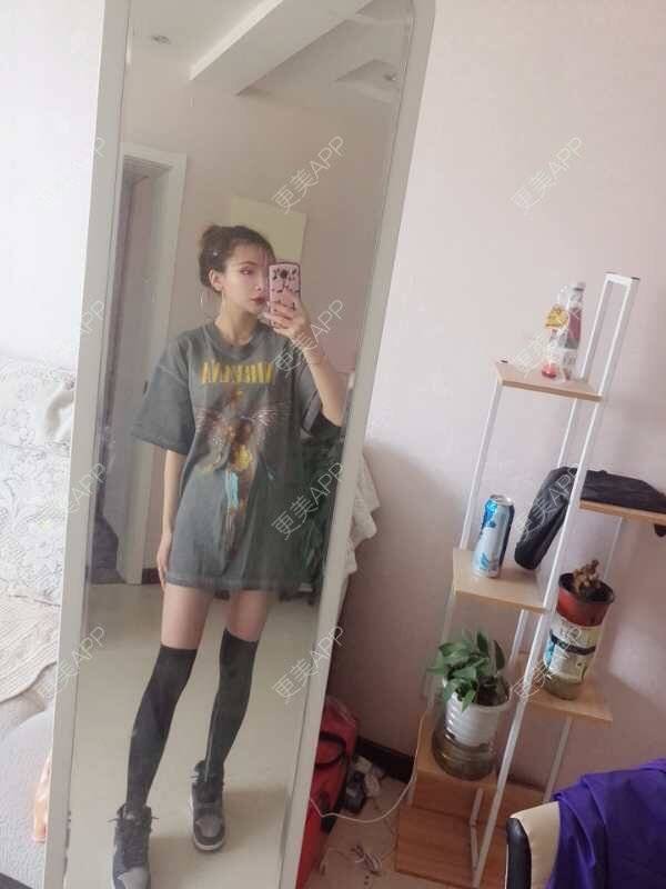 更美 - 心悦月的吸脂瘦大腿经验 | 吸脂瘦大腿 | 南宁 | 吸脂