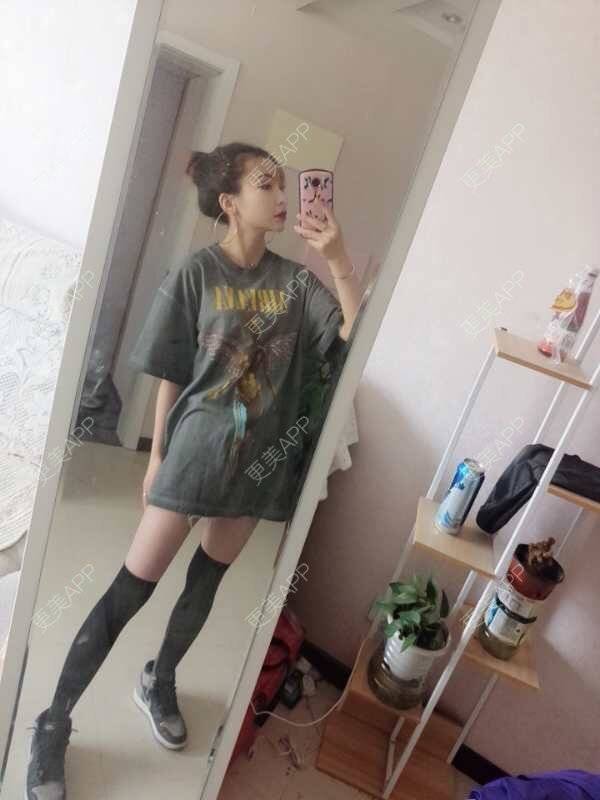 更美 - 心悦月的吸脂瘦大腿经验 | 吸脂瘦大腿 | 南宁 | 吸脂