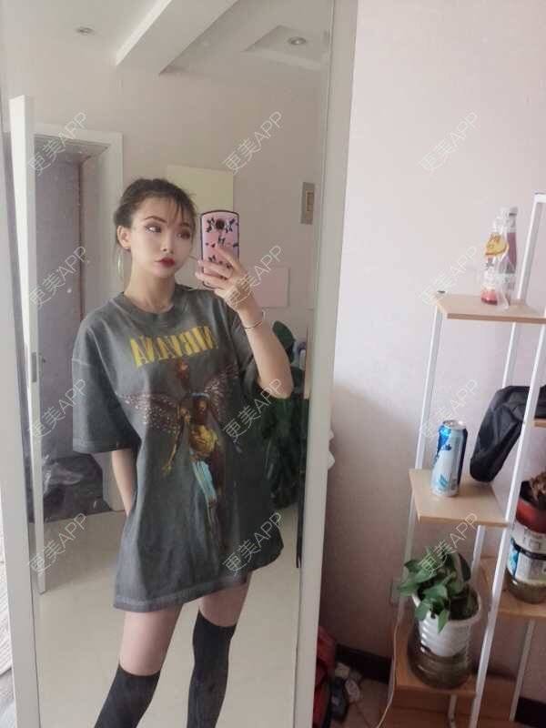 更美 - 心悦月的吸脂瘦大腿经验 | 吸脂瘦大腿 | 南宁 | 吸脂