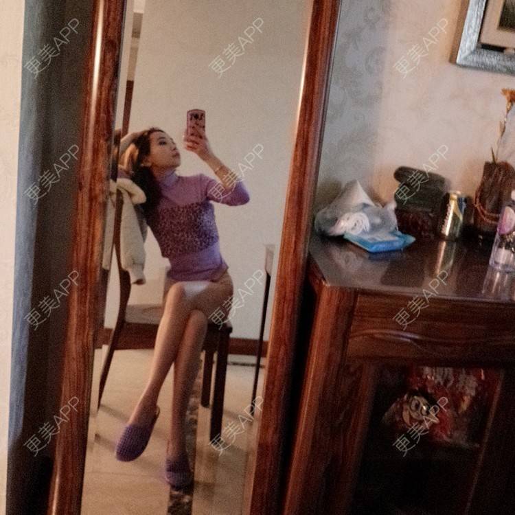 更美 - 心悦月的吸脂瘦大腿经验 | 吸脂瘦大腿 | 南宁 | 吸脂