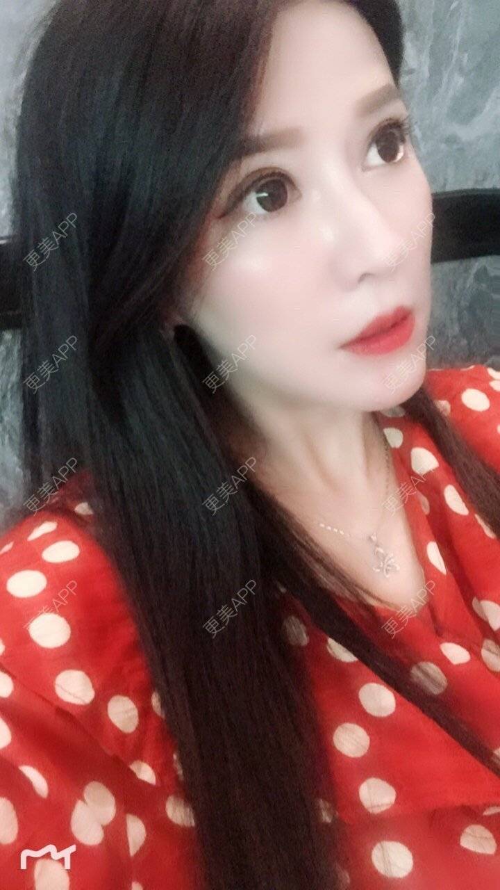 更美 - 甘思佳的热玛吉经验 | 北京 | 热玛吉