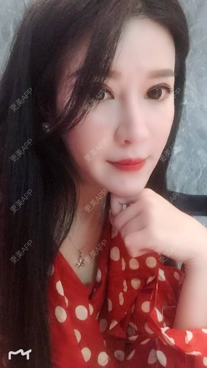 更美 - 甘思佳的热玛吉经验 | 北京 | 热玛吉