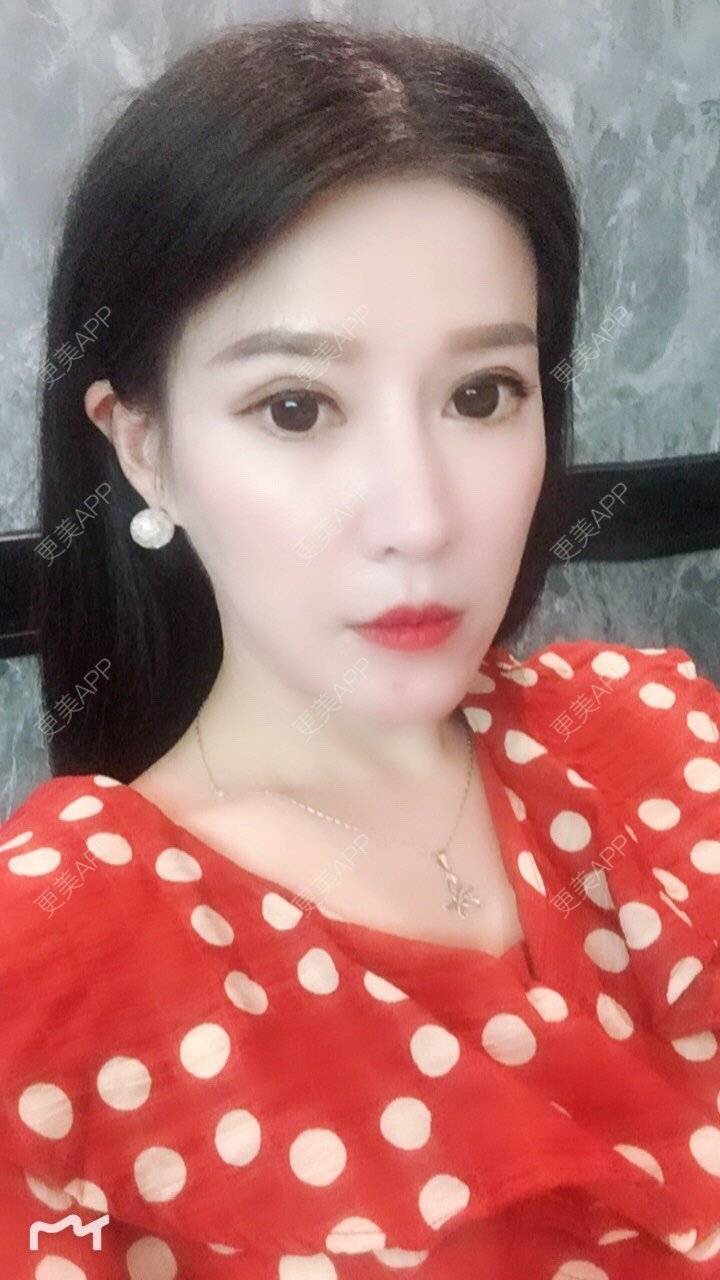 更美 - 甘思佳的热玛吉经验 | 北京 | 热玛吉